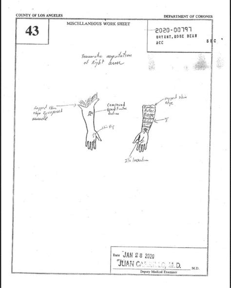 gigi autopsy sketch|Kobe Crash Autopsy Reports : r/CrimeScene